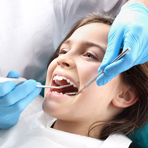 Dental Sealants Services