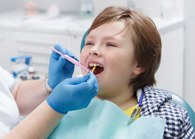 Fluoride Varnish