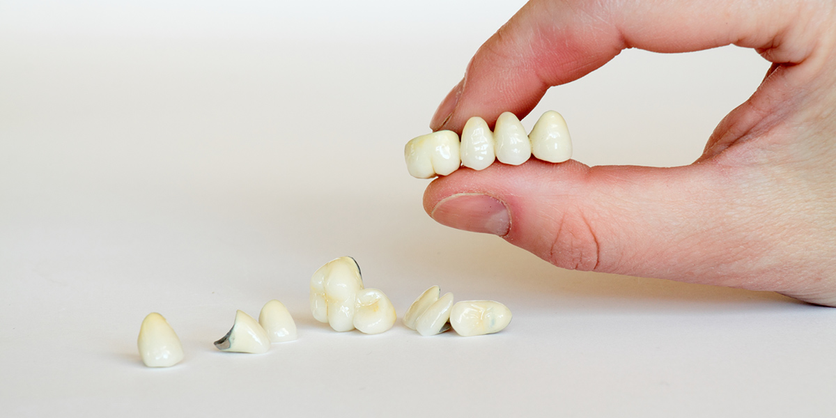 How Dental Crowns Protect Kids’ Teeth from Decay